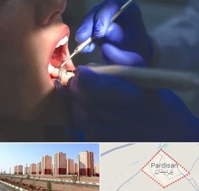 عصب کشی در پردیسان قم