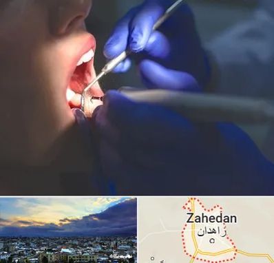 عصب کشی در زاهدان