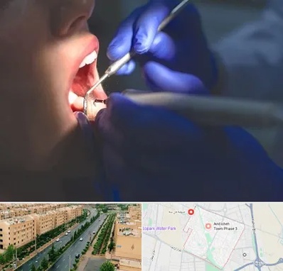 عصب کشی در فاز سه اندیشه