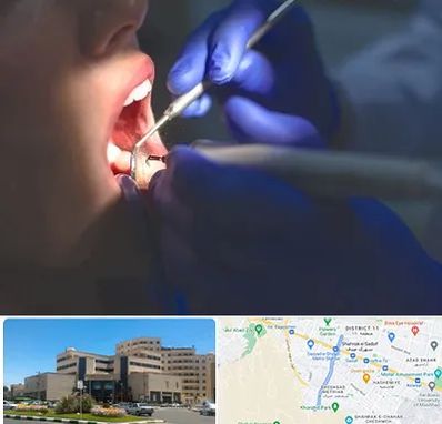 عصب کشی در صیاد شیرازی مشهد