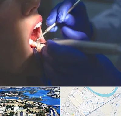 عصب کشی در کوروش اهواز