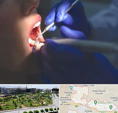 عصب کشی در پردیس