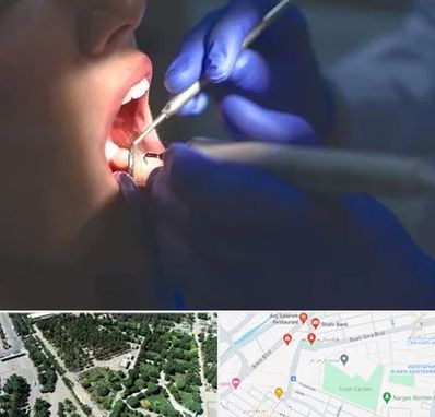 عصب کشی در سالاریه قم