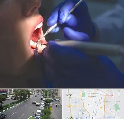 عصب کشی در ستارخان 