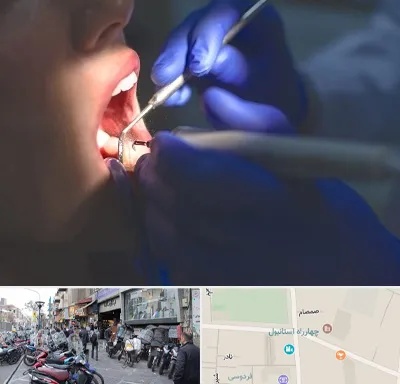 عصب کشی در چهارراه استانبول
