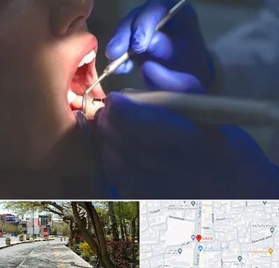 عصب کشی در خیابان توحید اصفهان