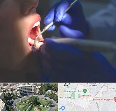 عصب کشی در جهانشهر کرج