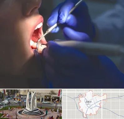 عصب کشی در زابل