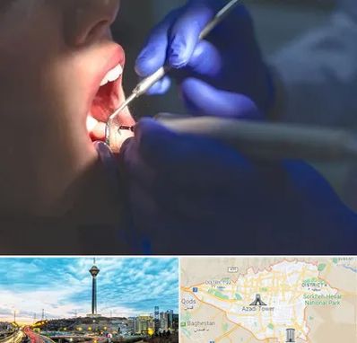 عصب کشی در تهران