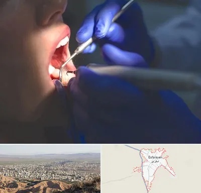 عصب کشی در اسفراین
