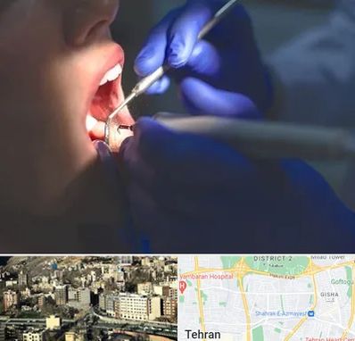 عصب کشی در مرزداران 