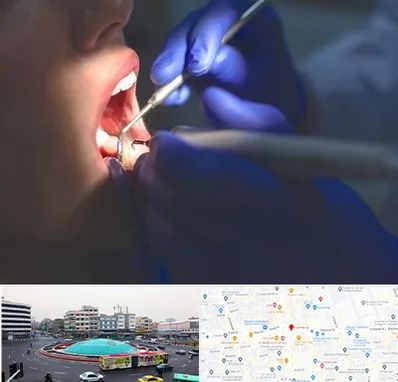 عصب کشی در میدان انقلاب