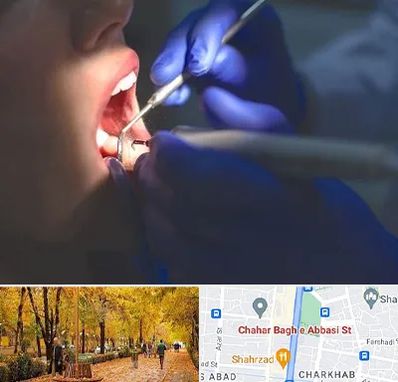 عصب کشی در چهارباغ اصفهان