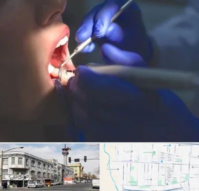 عصب کشی در 17شهریور