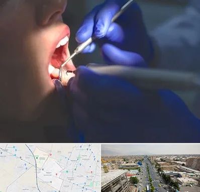 عصب کشی در حصارک کرج