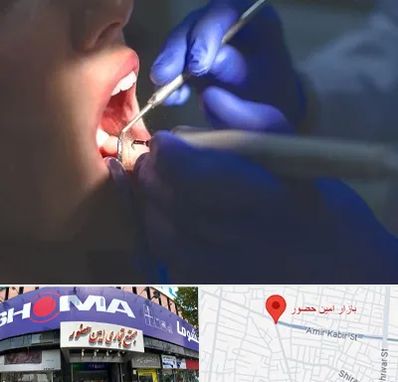 عصب کشی در امین حضور