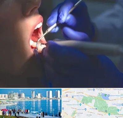 عصب کشی در چیتگر 