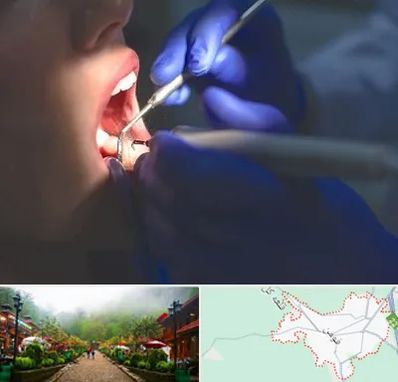 عصب کشی در فومن