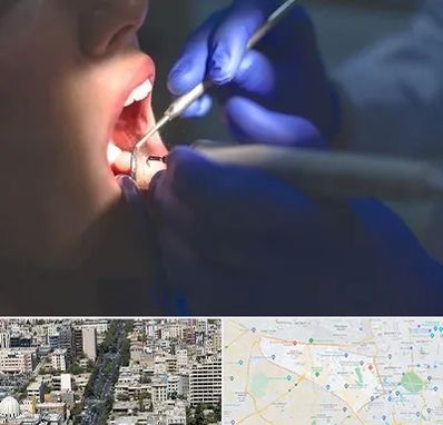 عصب کشی در منطقه 18 تهران