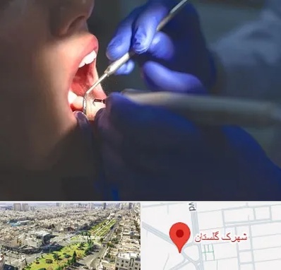 عصب کشی در شهرک گلستان