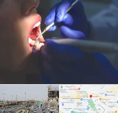 عصب کشی در بلوار توس مشهد