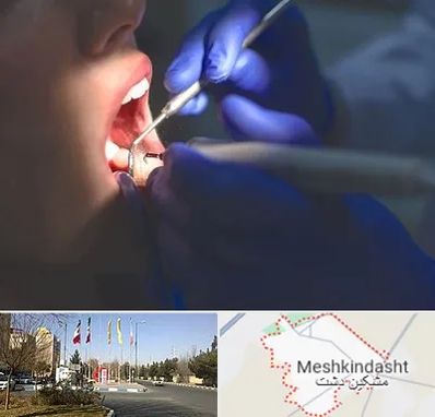 عصب کشی در مشکین دشت