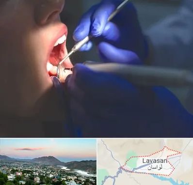 عصب کشی در لواسان
