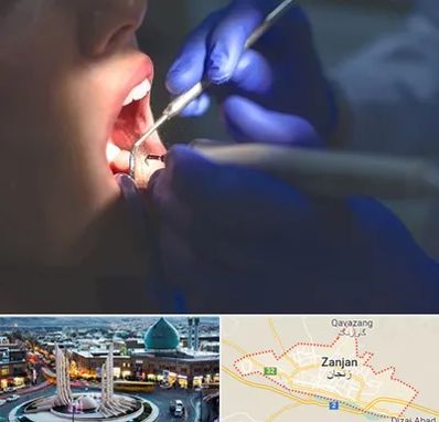 عصب کشی در زنجان