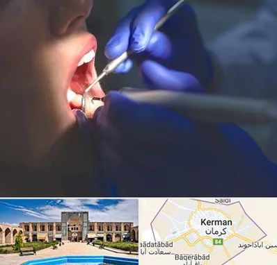 عصب کشی در کرمان