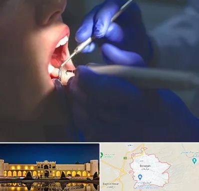 عصب کشی در برازجان