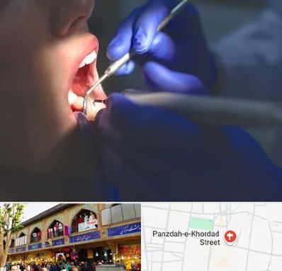 عصب کشی در 15 خرداد