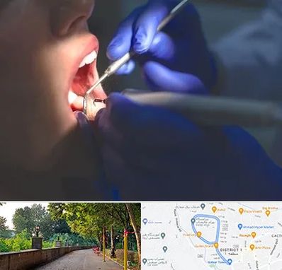 عصب کشی در بلوار گیلان رشت