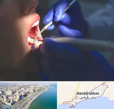 عصب کشی در بندرعباس