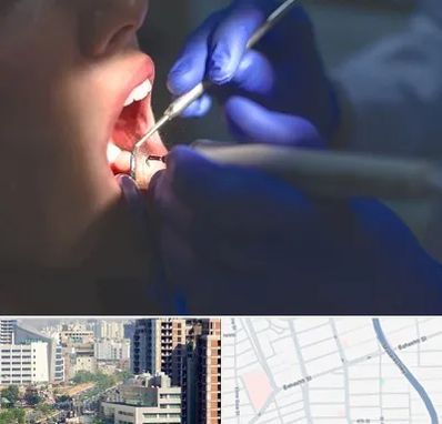 عصب کشی در خیابان بهشتی