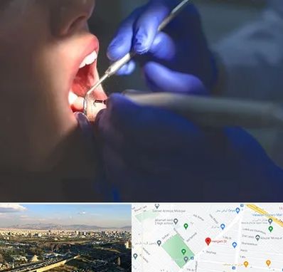 عصب کشی در هنگام