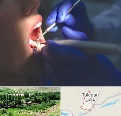 عصب کشی در طالقان