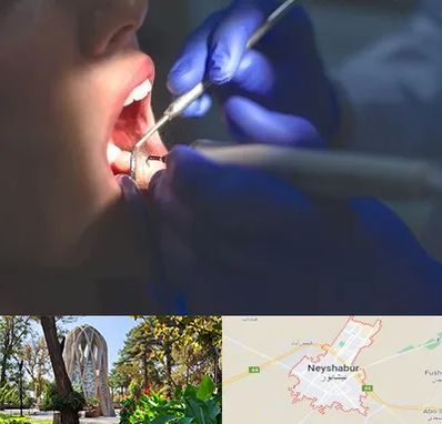 عصب کشی در نیشابور