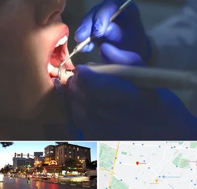 عصب کشی در بلوار سجاد مشهد