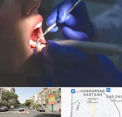 عصب کشی در چهارصد دستگاه