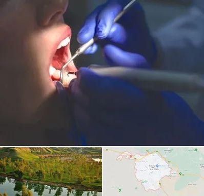 عصب کشی در بهبهان