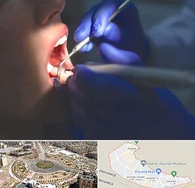 عصب کشی در پرند