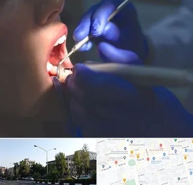 عصب کشی در میدان کاج