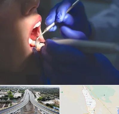 عصب کشی در اندیمشک