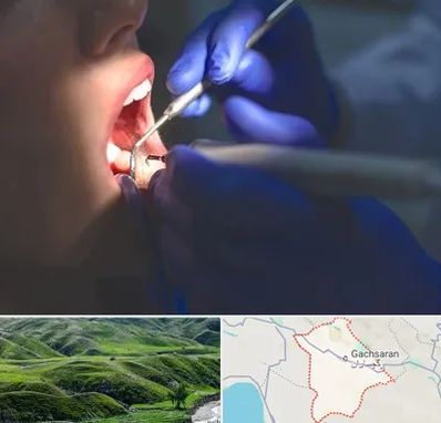 عصب کشی در گچساران