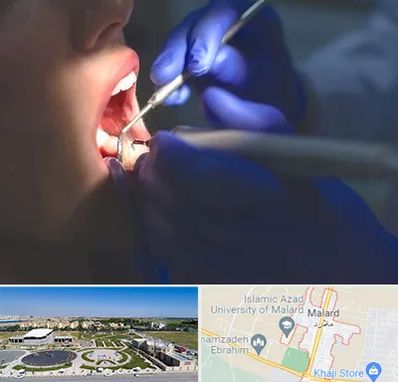 عصب کشی در ملارد