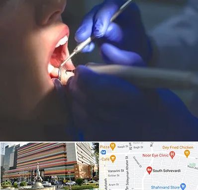 عصب کشی در سهروردی