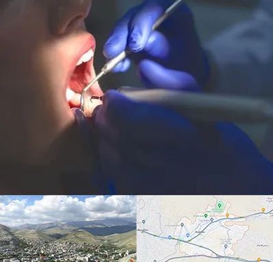 عصب کشی در رودهن