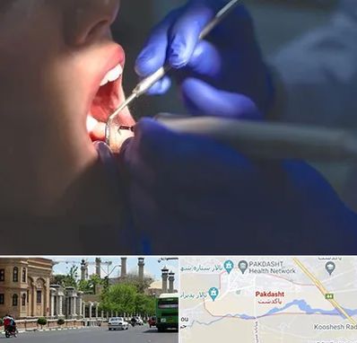 عصب کشی در پاکدشت