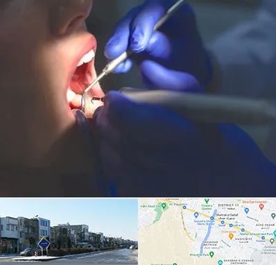 عصب کشی در شریعتی مشهد