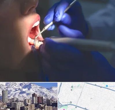 عصب کشی در ازگل